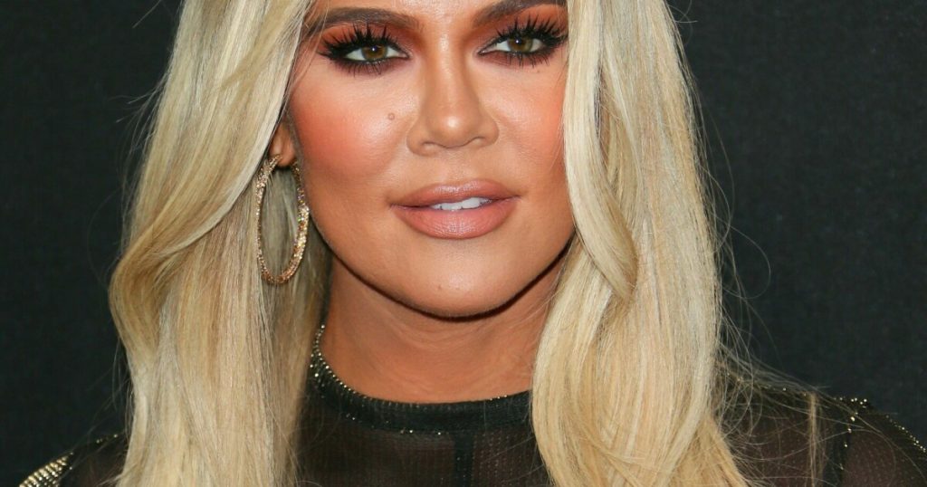 Khloe Kardashian: - Photopimples are allowed