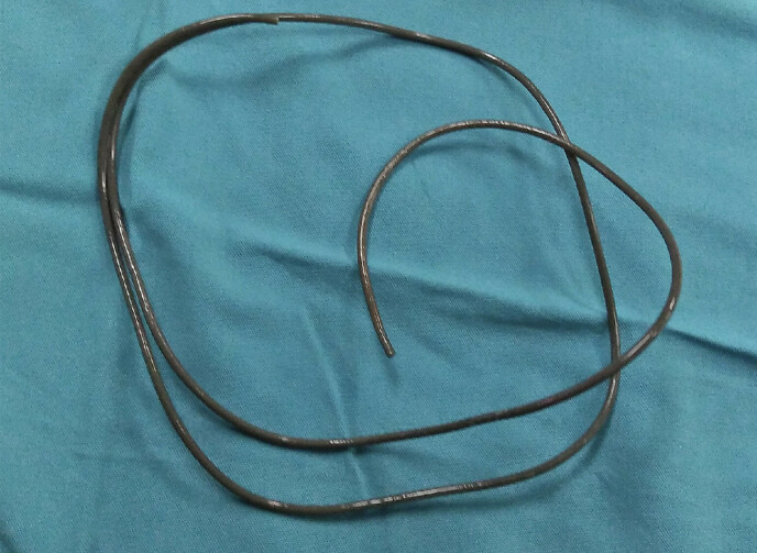 Long: Using a pair of pliers, the doctors were able to remove the earpiece wire, which was close to 80 cm.  Photo: Dr. Sutomo General Hospital
