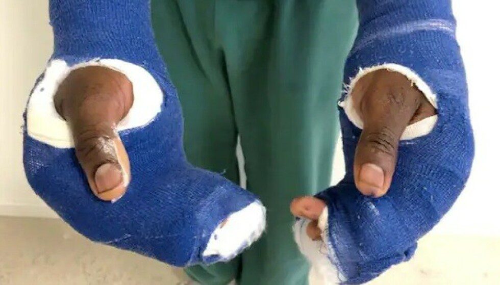 I had to sew: Kelvin Osagi's hand injuries had to be sutured.  He himself claimed that this came from the fact that he had to fend off the attacks of his wife.  Photo: Swedish police