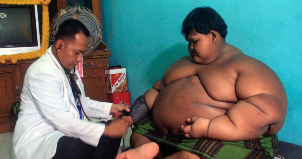 "The fattest boy in the world": - Elfil has changed
