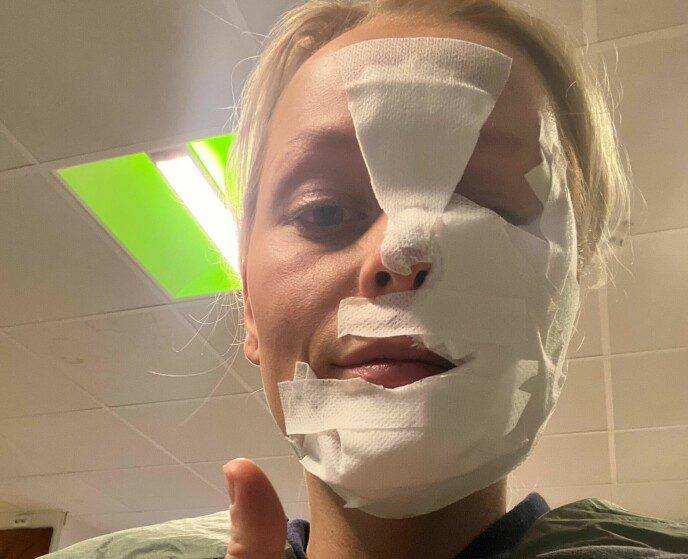 Injury: Maria had to wear a bandage for a while after the injury to reduce the risk of infection and inflammation.  Photo: Private.